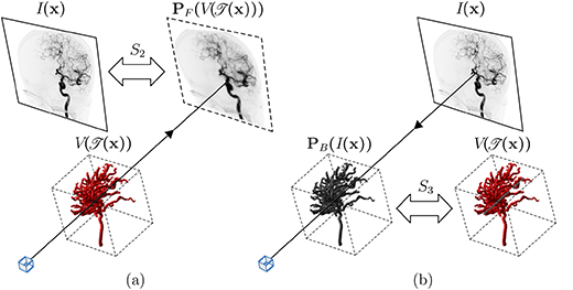 3D–2D registration of vascular structures - Book chapter - IOPscience
