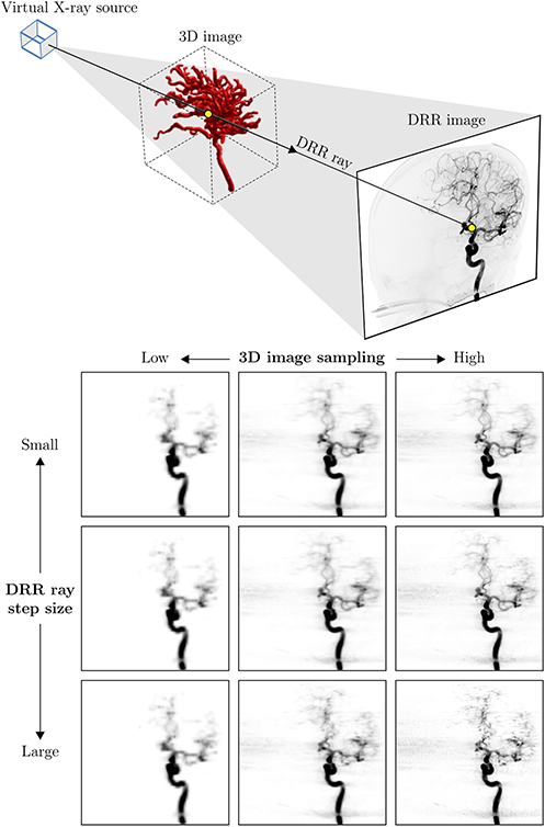 3D–2D registration of vascular structures - Book chapter - IOPscience