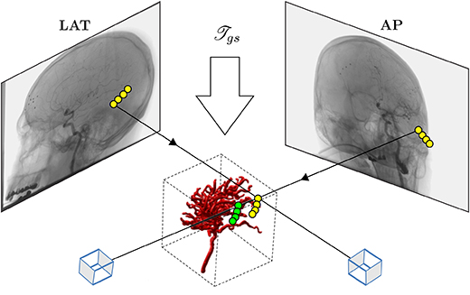 3D–2D registration of vascular structures - Book chapter - IOPscience