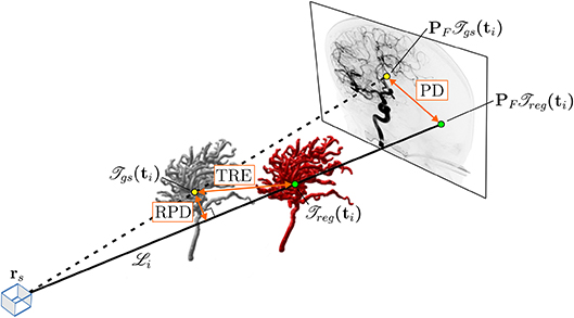 3D–2D registration of vascular structures - Book chapter - IOPscience