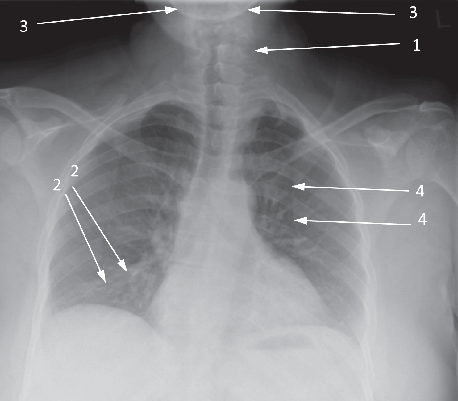 Thorax - Book chapter - IOPscience