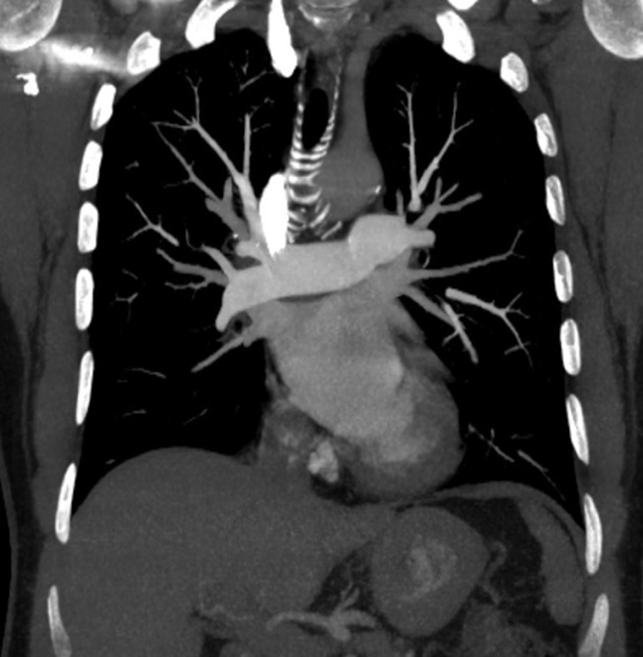 Thorax - Book chapter - IOPscience