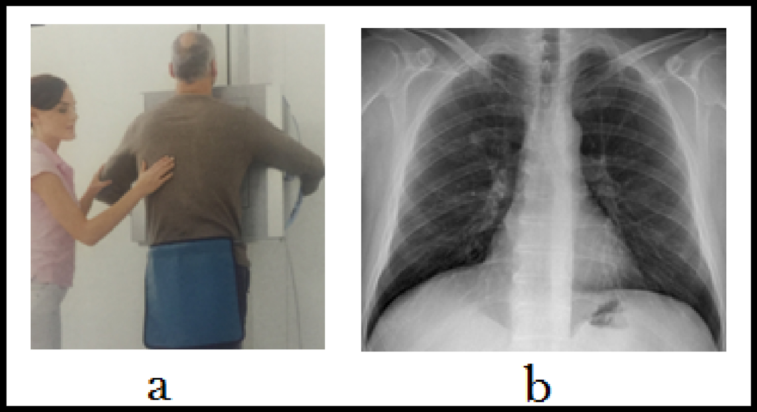 Ccot Radiographic On-screen CT - Book chapter - IOPscience