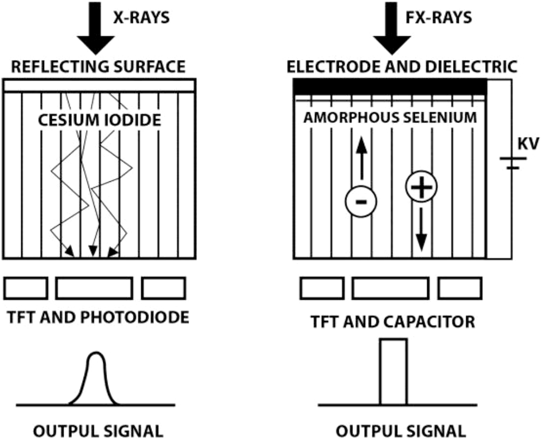 Digital radiography - Book chapter - IOPscience