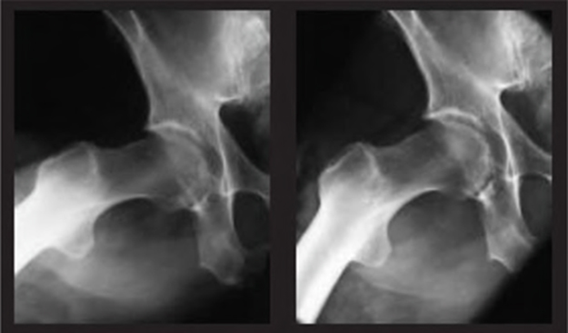 Digital radiography - Book chapter - IOPscience
