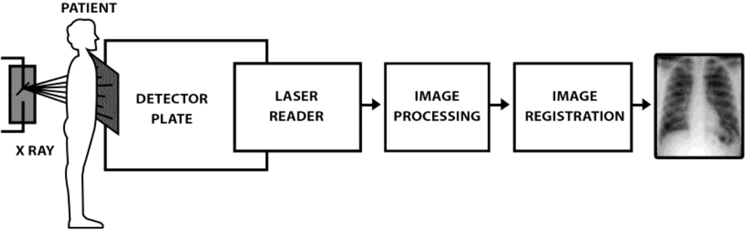 Digital radiography - Book chapter - IOPscience