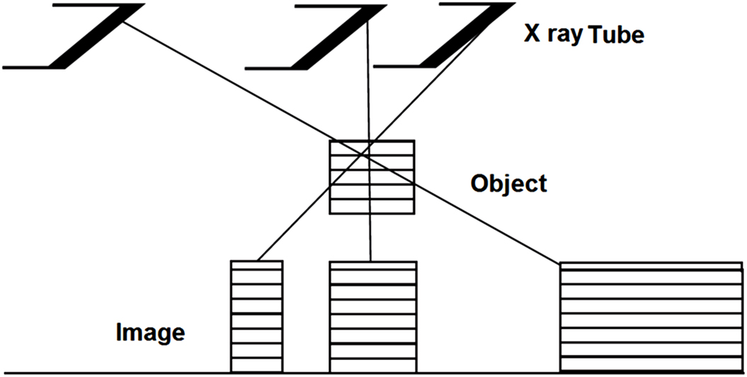 Radiographic quality - Book chapter - IOPscience
