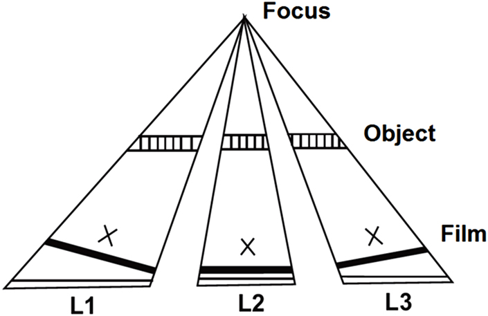 Radiographic quality - Book chapter - IOPscience