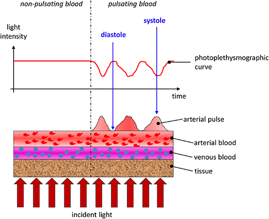 Lasers in medical diagnosis - Book chapter - IOPscience