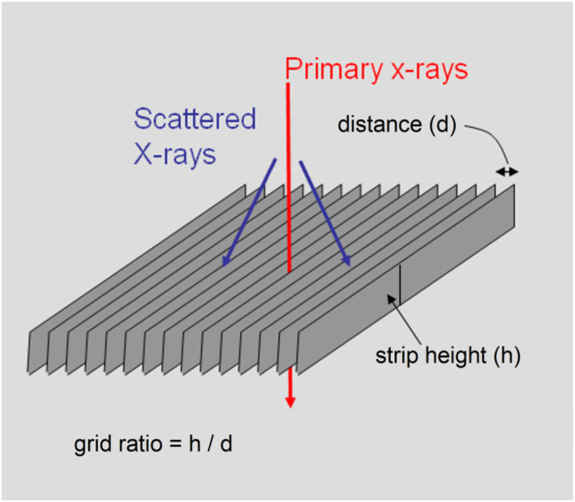 X-ray imaging - Book chapter - IOPscience