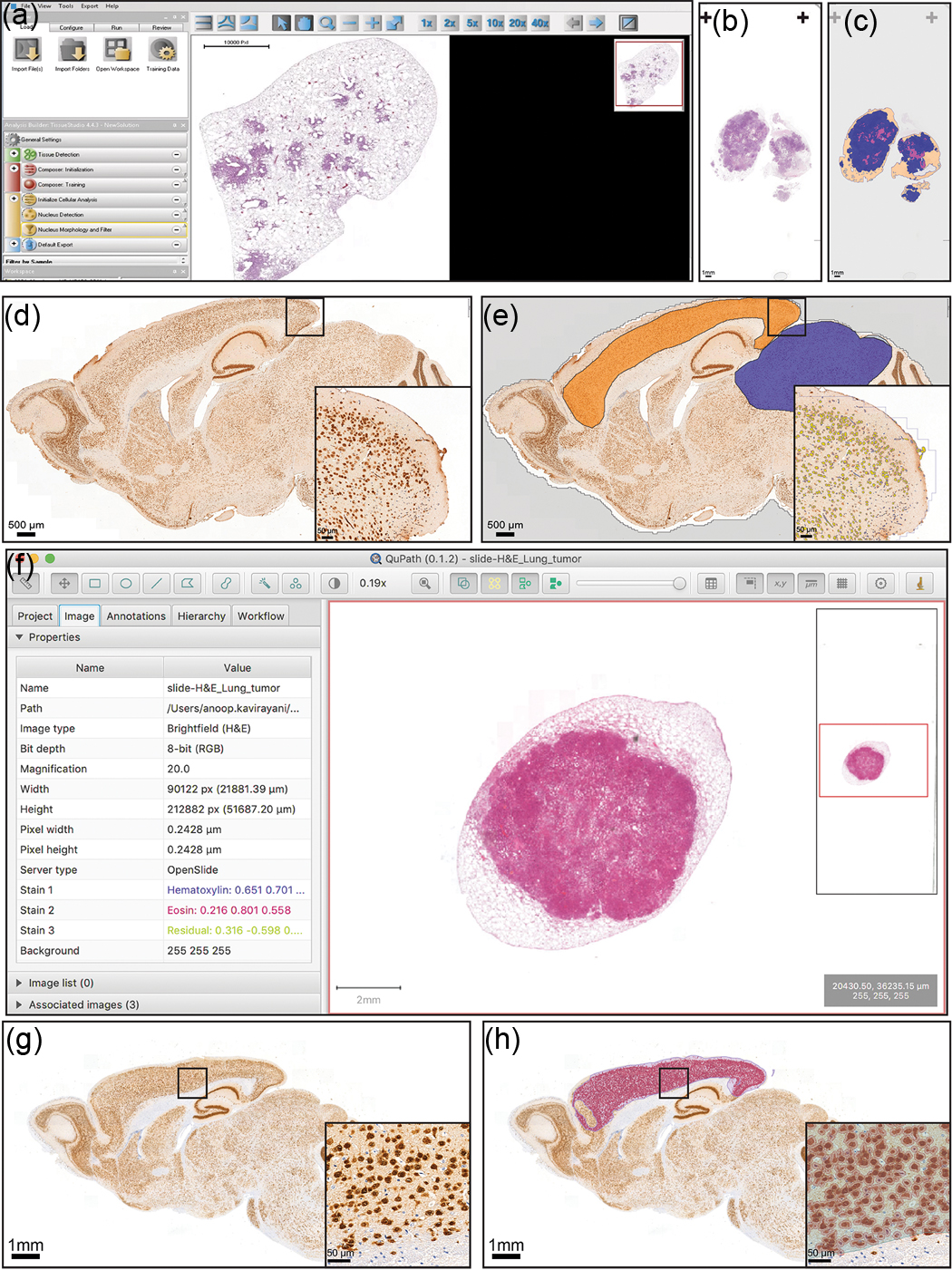 Pathological Map Histopathology - Book chapter - IOPscience