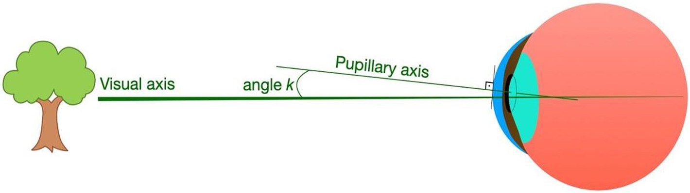 Aximmetry Eye Optical parameters and charts - Book chapter - IOPscience