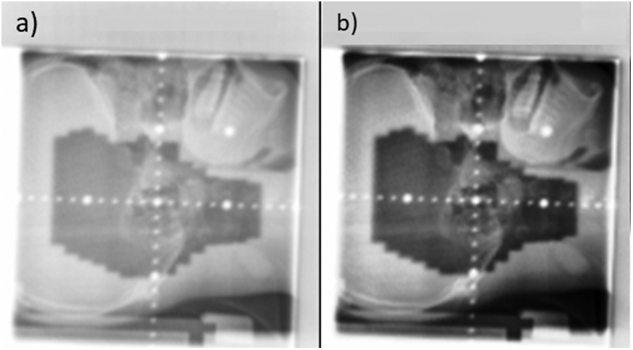 Two-dimensional (2D) off-line image guidance in radiation therapy ...