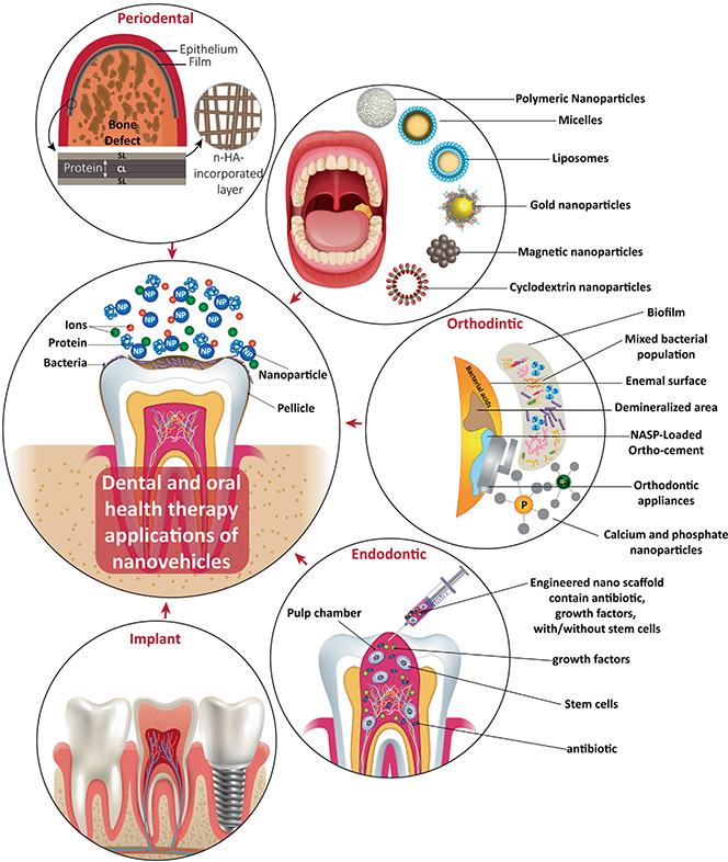 Tooth Structure Nano Roles of nanomedicines in dental therapeutics - Book chapter - IOPscience