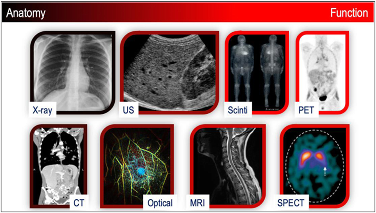 Basic Imaging Introduction to imaging modalities - Book chapter - IOPscience