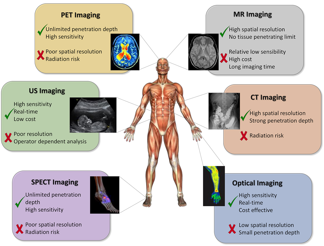 Introduction to imaging modalities - Book chapter - IOPscience