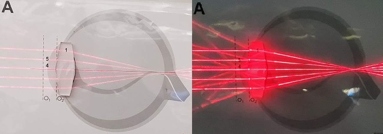 Human eye and corrective lenses - Book chapter - IOPscience