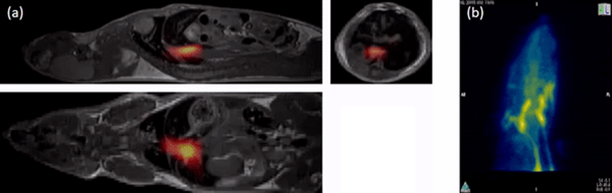 Mpi Medical Examples Magnetic particle imaging - Book chapter - IOPscience