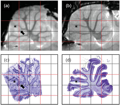 Multimodal image registration - Book chapter - IOPscience