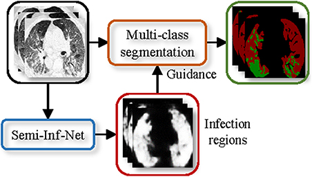 Inf-Net: an automatic lung infection segmentation network that uses CT ...