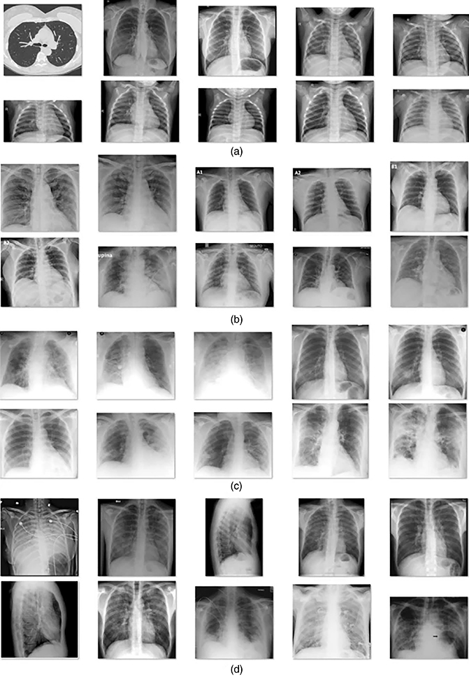 Role of deep learning strategies in detecting COVID-19 pneumonia - Book ...