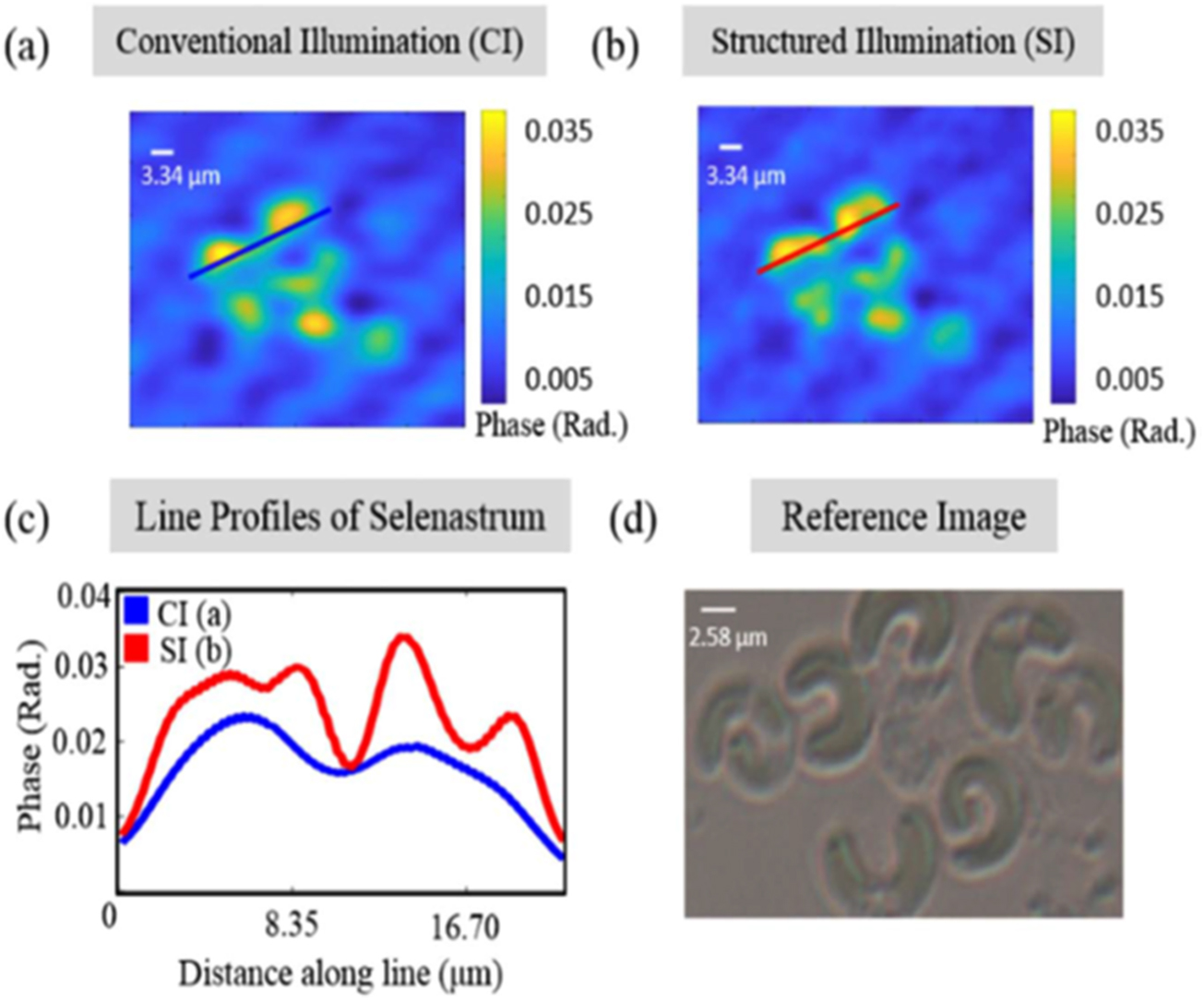 Structured illumination quantitative phase microscopy - Book chapter ...