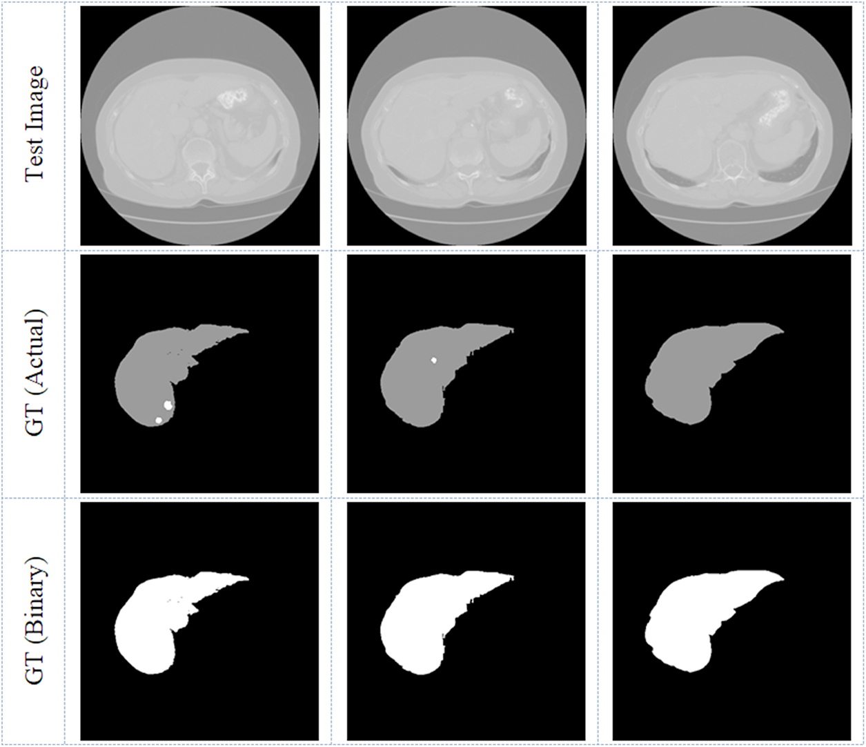 Liver Graph Medical-imaging-supported disease diagnosis - Book chapter - IOPscience