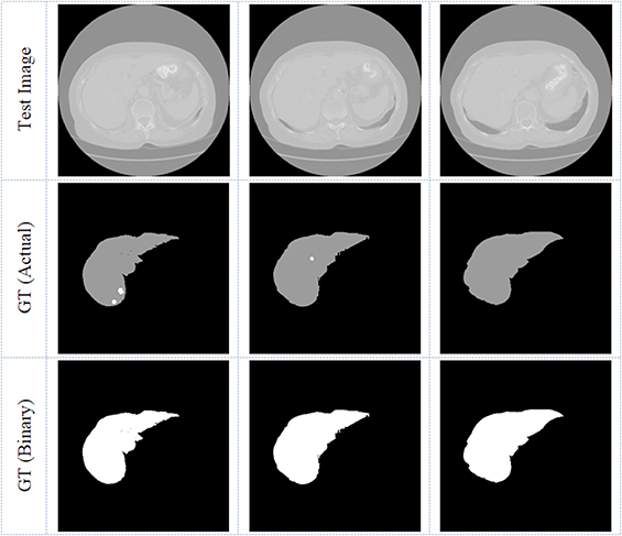 Medical-imaging-supported disease diagnosis - Book chapter - IOPscience