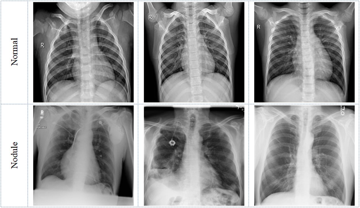 Medical-imaging-supported disease diagnosis - Book chapter - IOPscience