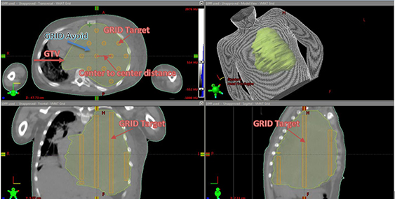 Rotational arc SFRT - Book chapter - IOPscience