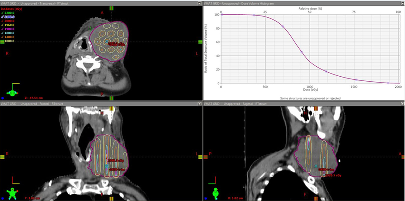 Rotational arc SFRT - Book chapter - IOPscience