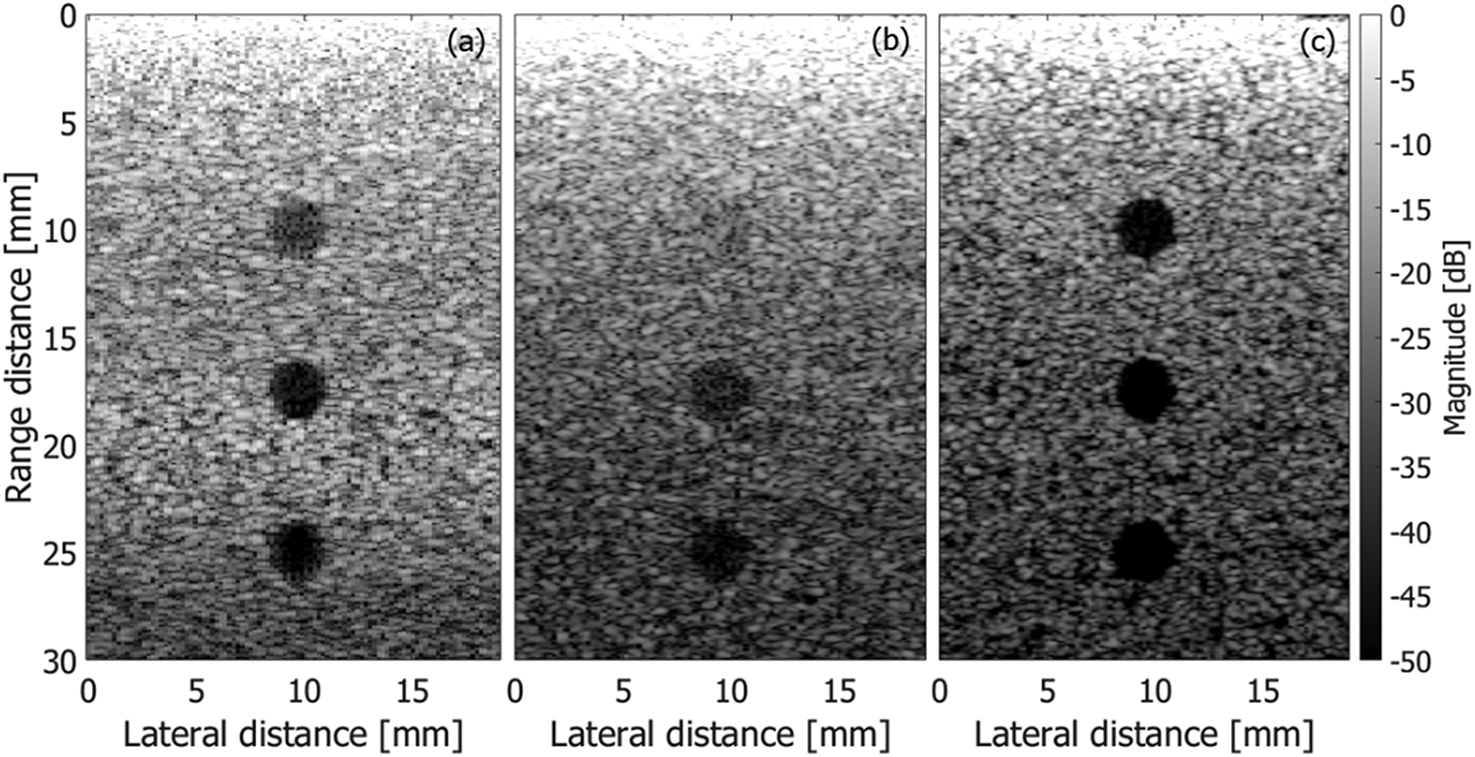 Picture Frame Pattern Radiography High-frame-rate medical ultrasonic imaging - Book chapter - IOPscience