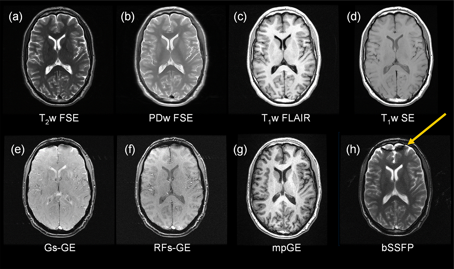 Pulse sequences and images - Book chapter - IOPscience