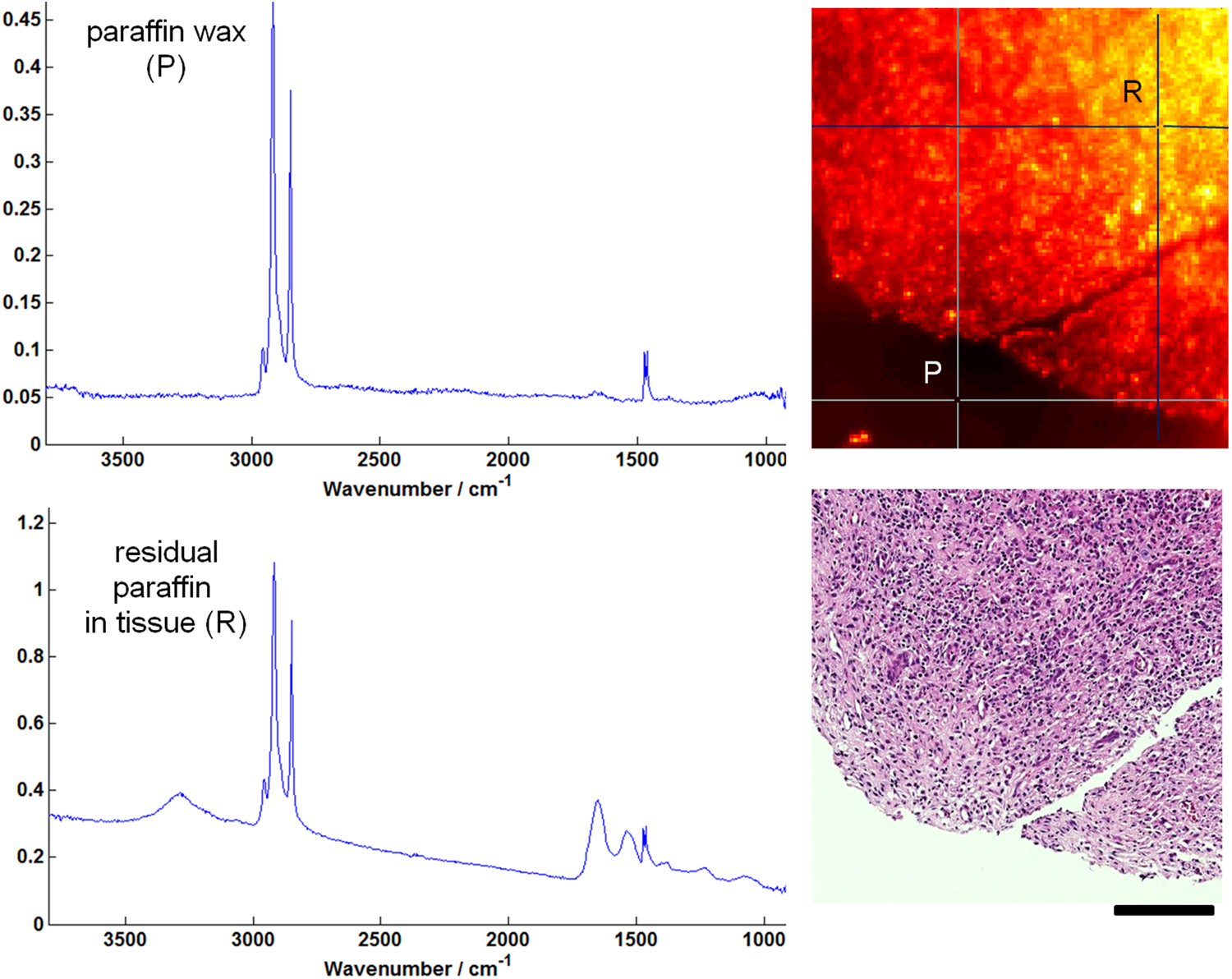 Vibrational biomedical spectroscopy of tissue - Book chapter - IOPscience
