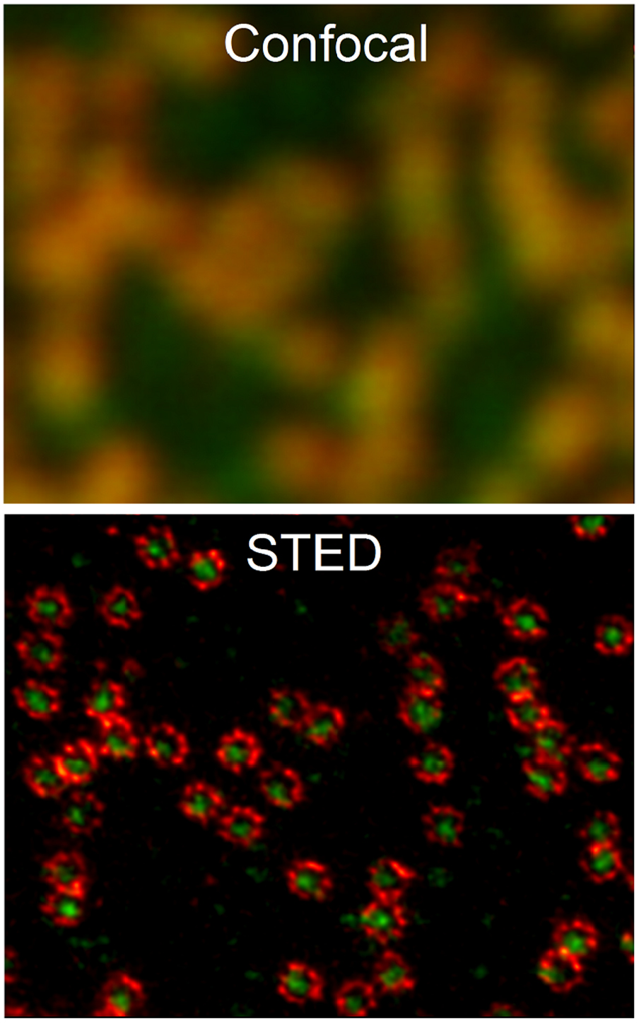 The 2015 super-resolution microscopy roadmap - IOPscience