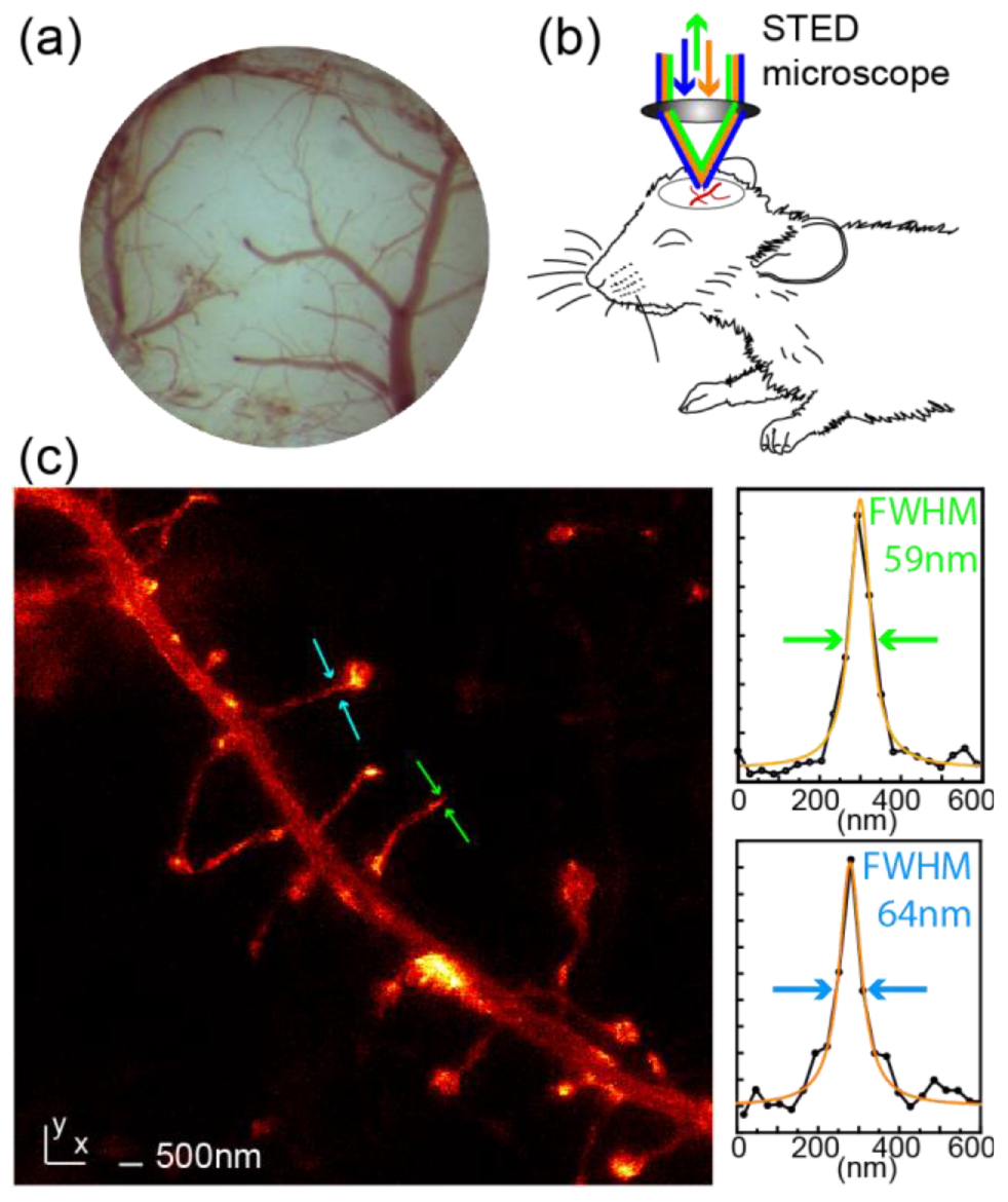 The 2015 super-resolution microscopy roadmap - IOPscience
