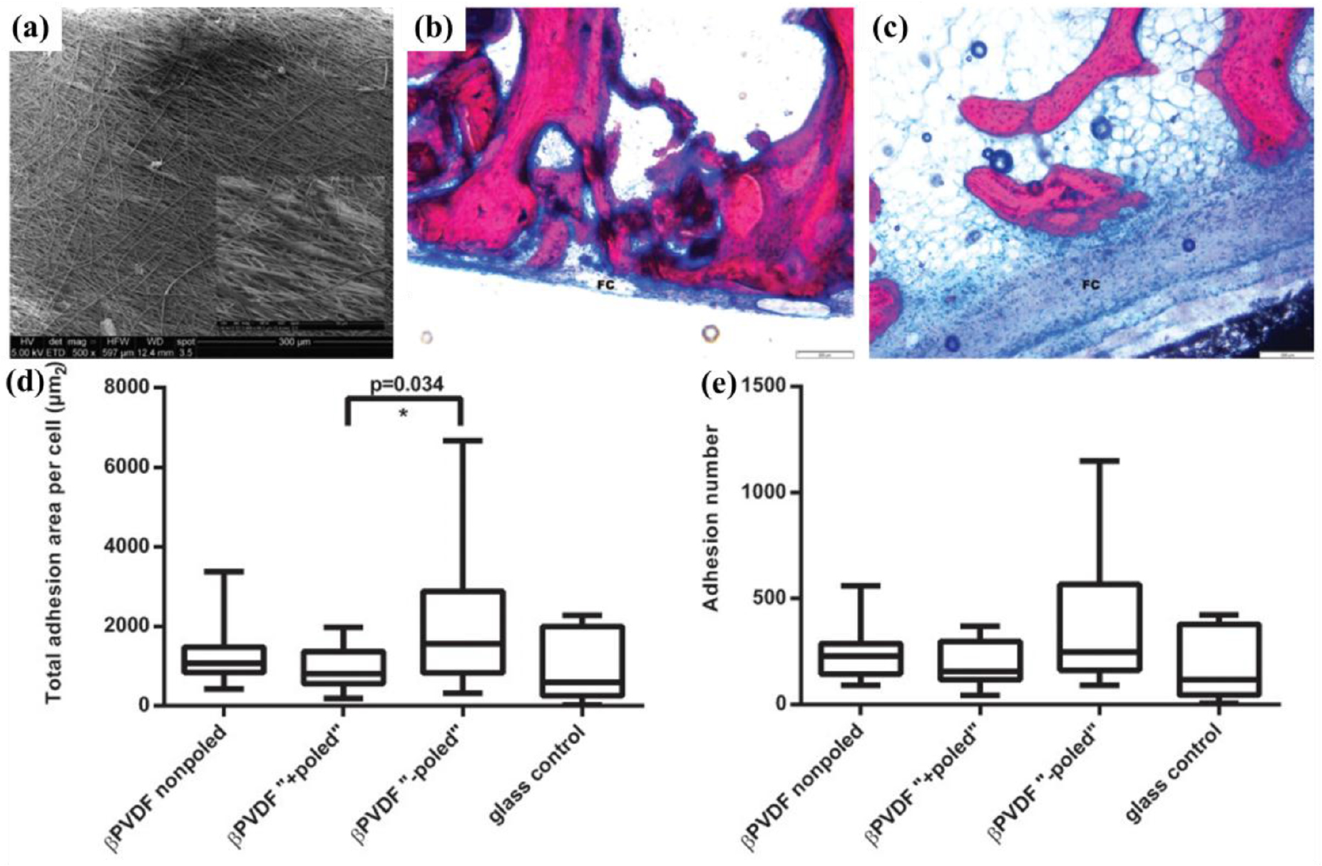Design and application of piezoelectric biomaterials - IOPscience