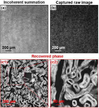 Ptychographic modulation engine: a low-cost DIY microscope add-on for ...