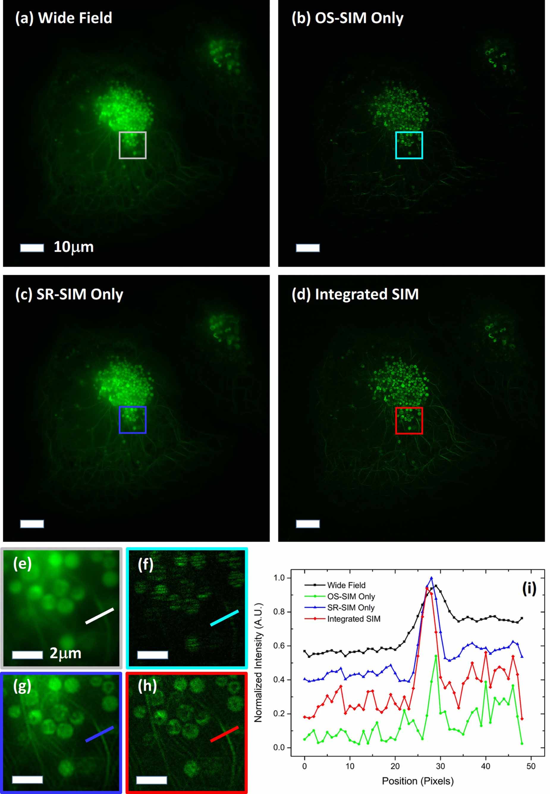 Super-resolution and optical sectioning integrated structured ...