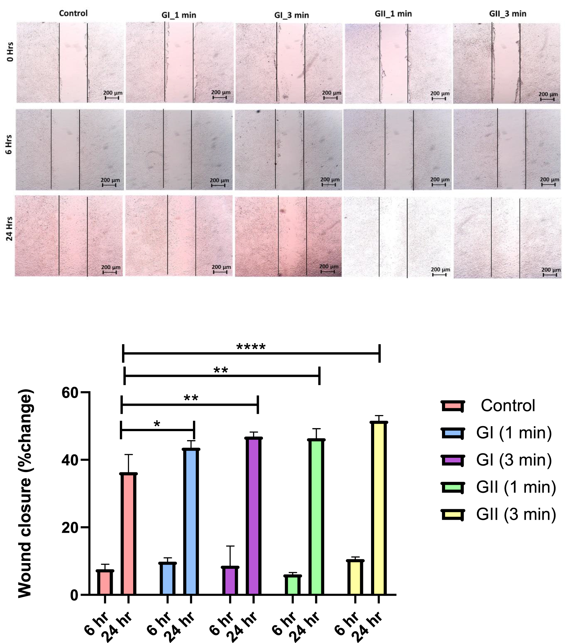 Biochemical evaluation of wound healing efficacy of cold plasma ...