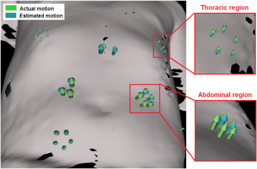 Multi-dimensional respiratory motion tracking from markerless optical ...