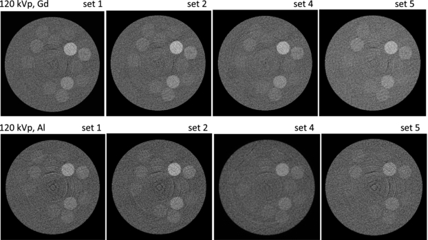 Photon counting spectral CT: improved material decomposition with K ...