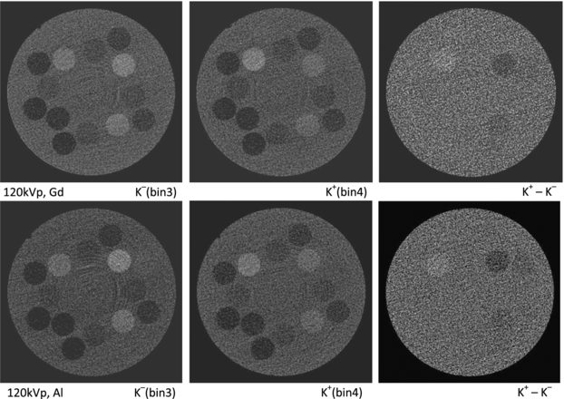 Photon counting spectral CT: improved material decomposition with K ...