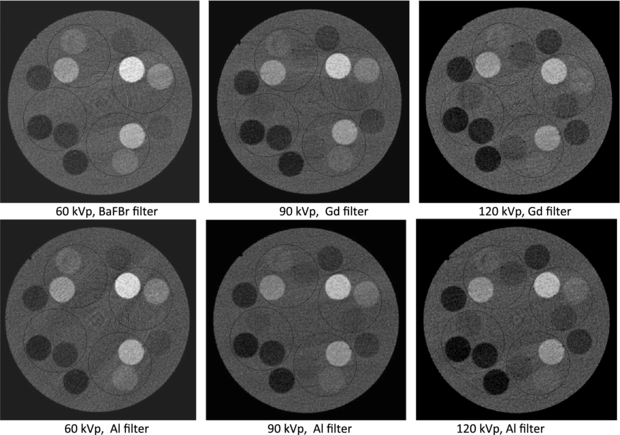 Photon counting spectral CT: improved material decomposition with K ...