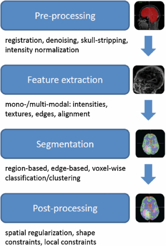 A survey of MRI-based medical image analysis for brain tumor studies ...