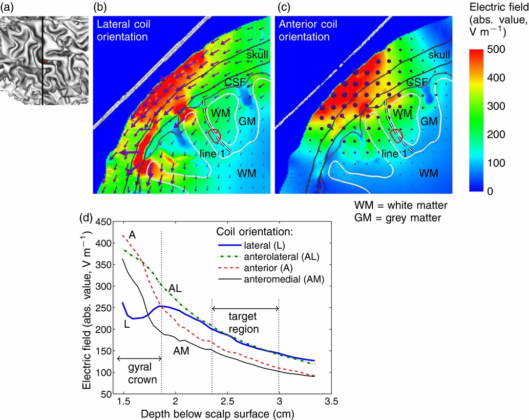 Effects of coil orientation on the electric field induced by TMS over ...