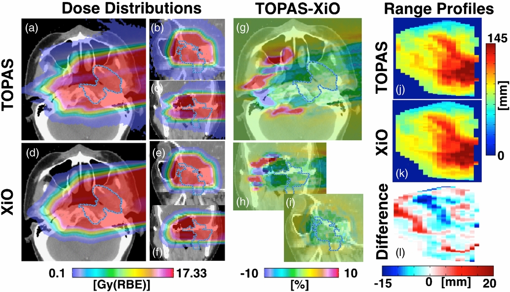 Site-specific range uncertainties caused by dose calculation algorithms ...