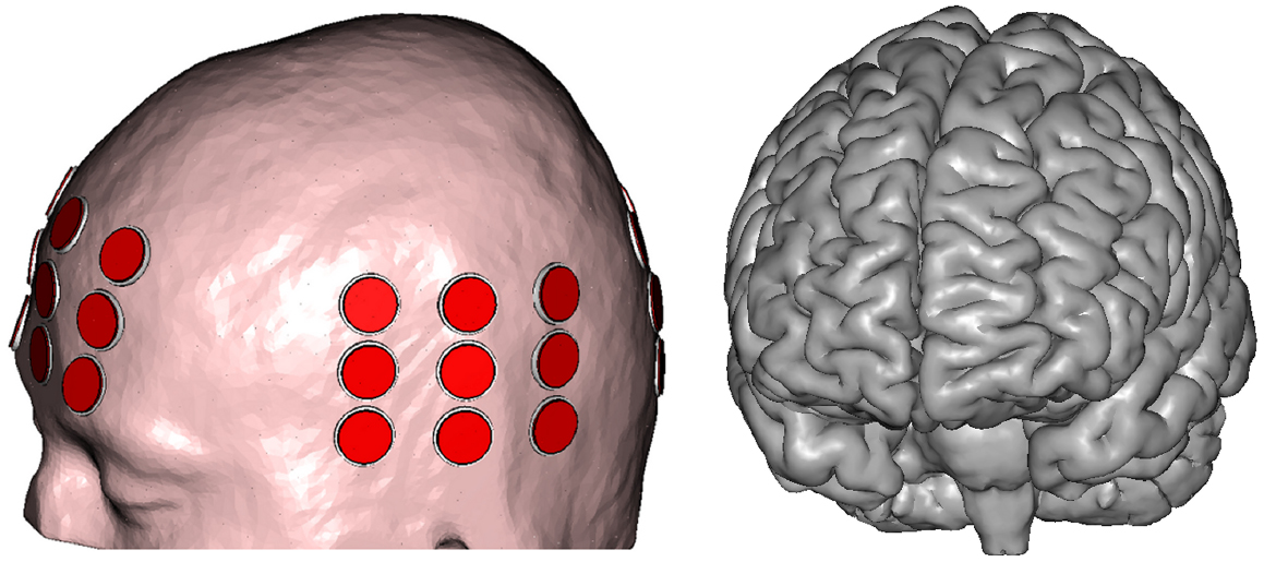 Predicting the electric field distribution in the brain for the ...