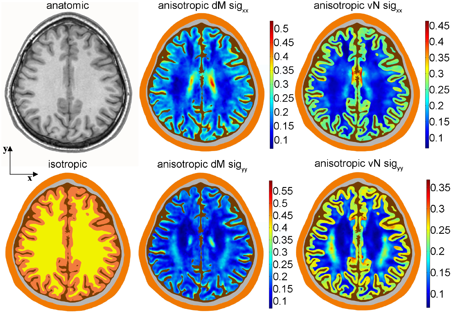 The electric field distribution in the brain during TTFields therapy ...