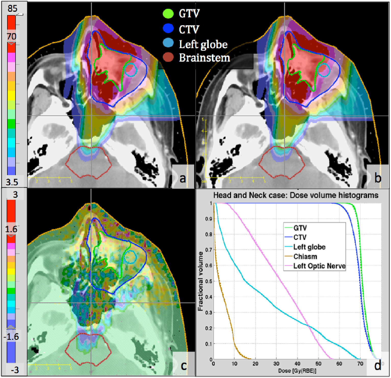 Validation of a GPU-based Monte Carlo code (gPMC) for proton radiation ...